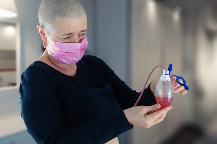 Photo shows a woman checking her drainage system, noticing the reddish fluid typical of initial mastectomy recovery/Getty Images