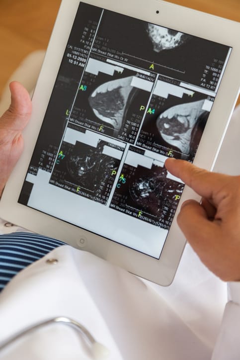 Photo shows a doctor holding an iPad and looking at mammogram results/Getty Images